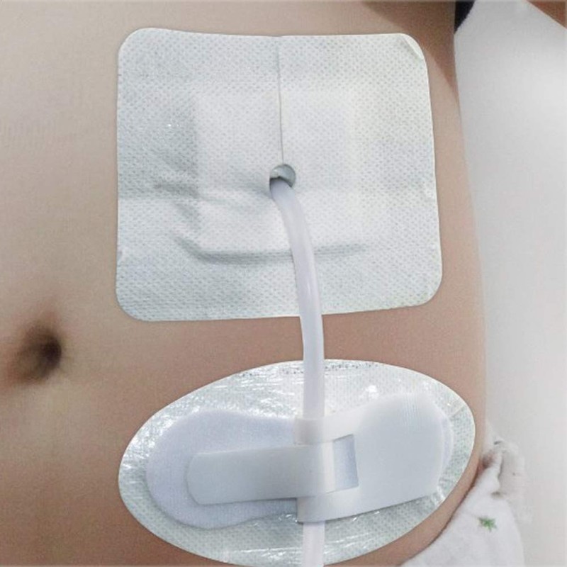 Lifevv 5 PCS Catheter Legband Holder,Surface Tube fix Device with