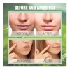 2pcs Tira Verde Mascarilla Facial Extracto
