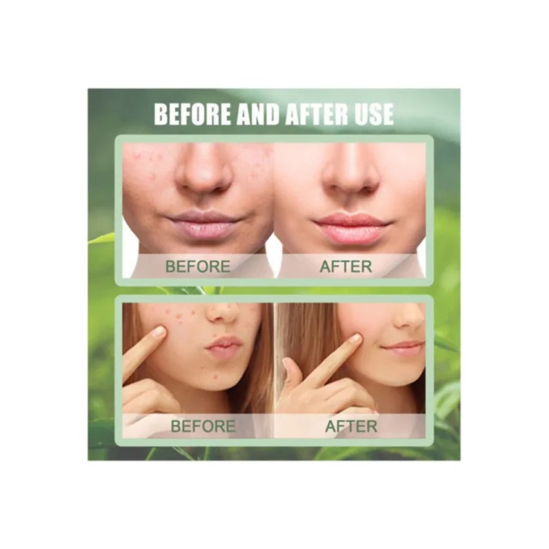2pcs Tira Verde Mascarilla Facial Extracto