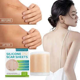 Parche De Silicona KENAXUAN Reutilizable Para Cicatrices 1.5m