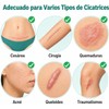 Parches Silicona para Cicatrices – Láminas Reutilizables para Cesárea y