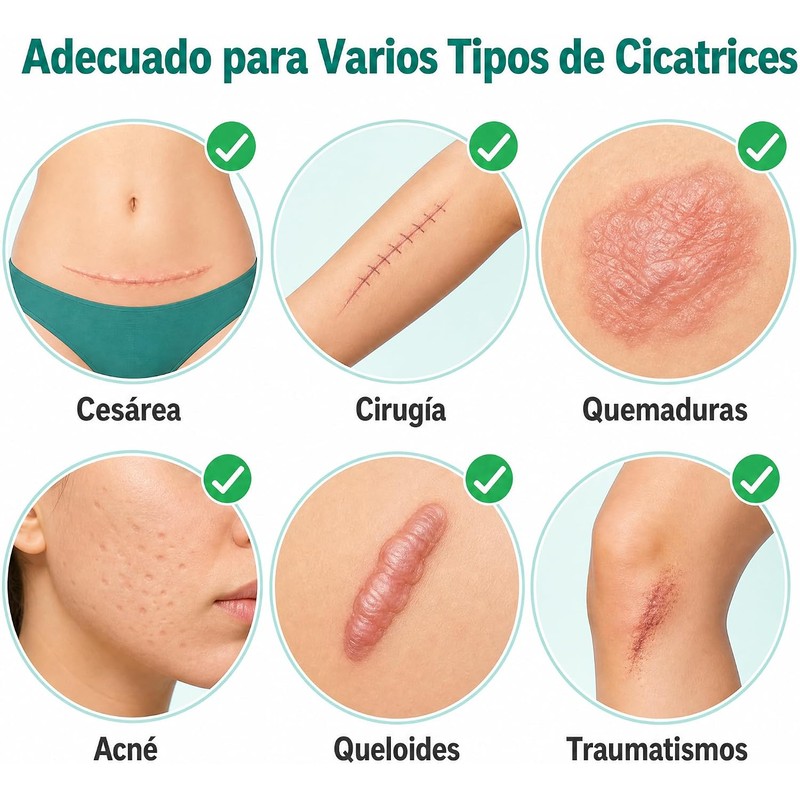 Parches Silicona para Cicatrices – Láminas Reutilizables para Cesárea y