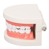 Dental Disease Caries Teeth Model Resin Simulation Teaching Prop Dental
