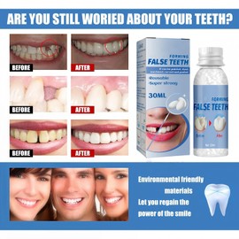 2PCS Temporary Tooth Filling,Temporary Tooth Repair Kits,Temporary Tooth Filling Repair Kit with Moldable False Teeth,Teeth Replacement Kit,Dent/ure False Teeth Repair Beads for MissingTooth