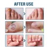 Advanced Nail Formula for Toenail and Fingernail - Nourishing and