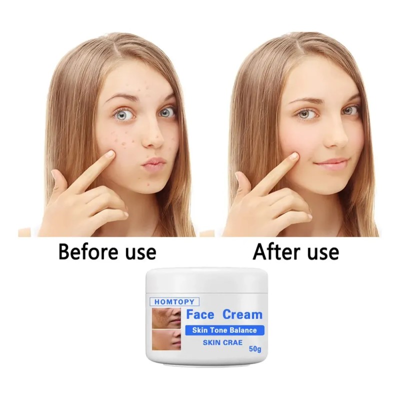 Crema Aclaradora Facial Moteada 50 G, Melasma Speckle Moistu