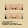 SOME BY MI [SOME BY MI]*renewal* Yuja Niacin Brightening Toner