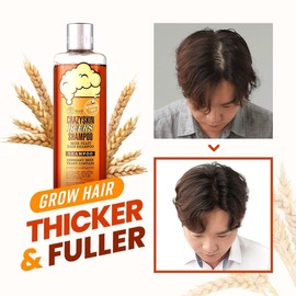 CRAZY SKIN German Beers Yeast Biotin Shampoo for Hard water, Anti-hair loss, and Thickening,Gentle Exfoliating & Scalp Function with Panthenol, Collagen and Free-Sulfate, Chemical, 300ml(10.15oz)