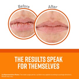 O'Keeffe's Unscented Lip Repair Lip Balm for Dry, Cracked Lips, Stick, (Pack of 12)