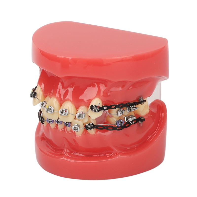 Professional Dental Demonstration Orthodontic Model with Metal Wires and Bracket