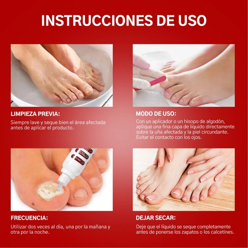 Fungicida Para Uñas Con Hongos, Amarillas,engrosadas Y Duras