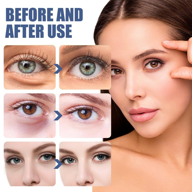 1 x Jasmine Ointment Eye Active Jasmine Ointment, 100 ml
