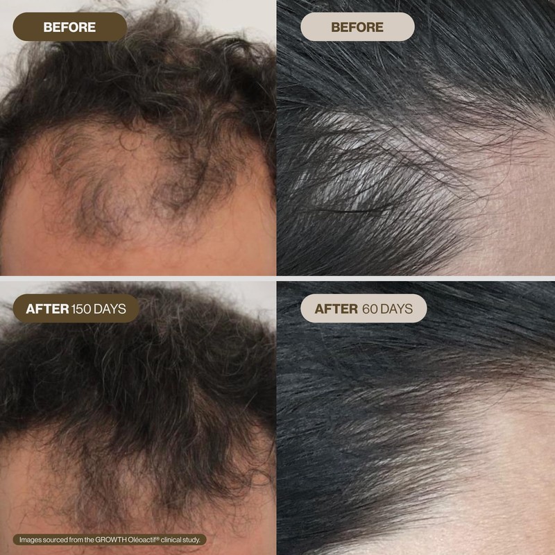 NATURAVIT Rosmarion Oil and Water Bundle