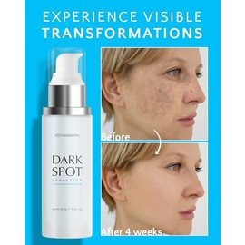 EnaSkin Eliminador de manchas oscuras para rostro y cuerpo: crema corrector de manchas de fórmula avanzada para desvanecer manchas de la edad, manchas