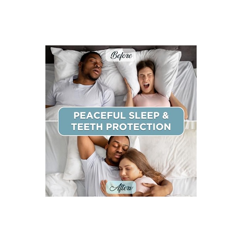 Mouth Guard for Grinding Teeth at Night: Moldable Sleeping Mouthguards