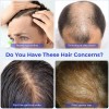 Serum Para El Crecimiento Del Cabello Eoiroa Con 3% De