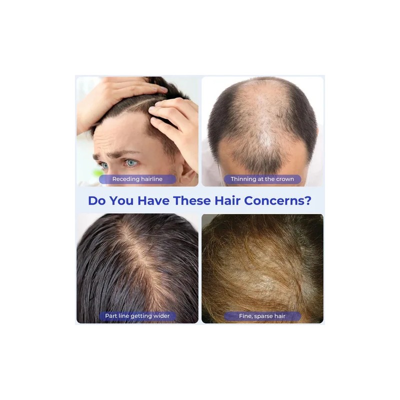 Serum Para El Crecimiento Del Cabello Eoiroa Con 3% De