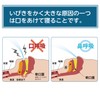 大容量300枚入 口テープ いびき防止テープ 鼻呼吸テープ いびきを減らし 喉の痛みを防ぎます 口臭を改善 いびき防止グッズ 口呼吸防止テープ 鼻呼吸促進