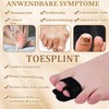 Pack of 2 Black Hammer Toe Splint with Aluminium Plates,