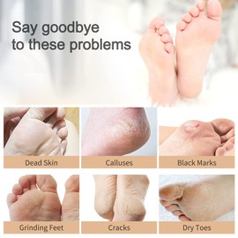 La.Personal Foot Care Set, 5 Pairs of Foot Mask, Callus Socks, Foot Scrub Mask, Foot Mask with Foot File and Socks - Effective for Calluses, Deep and Dry Skin, Deep Cracked Heels Repair