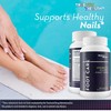 Probiotic Foot Care - Our Best Nail Fungus Support for