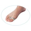 Bunion (173) Left and Right Bunions, Pack of 2