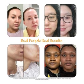 Hairtamin Skintamin Píldoras De Colágeno Vegetariano 30caps