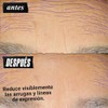 Kiehl's Retinol Skin-Renewing Daily MicroDose Serum - Suero Facial Antiedad