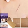 8 Parches Silicona Reutilizables Cicatrices Grado Medico F