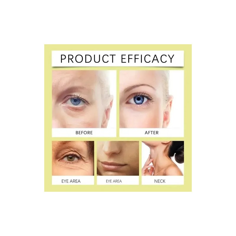 (jjlsss) Hgfhgfg Al Celimax The Vita A Retinal Shot, Esencia