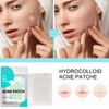 Pimple Patches for Face (360Pcs /10 Sheet), Transparent Acne Patche