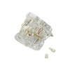 Modelo de implante de dientes, para enseñanza, modelo de enfermedad,