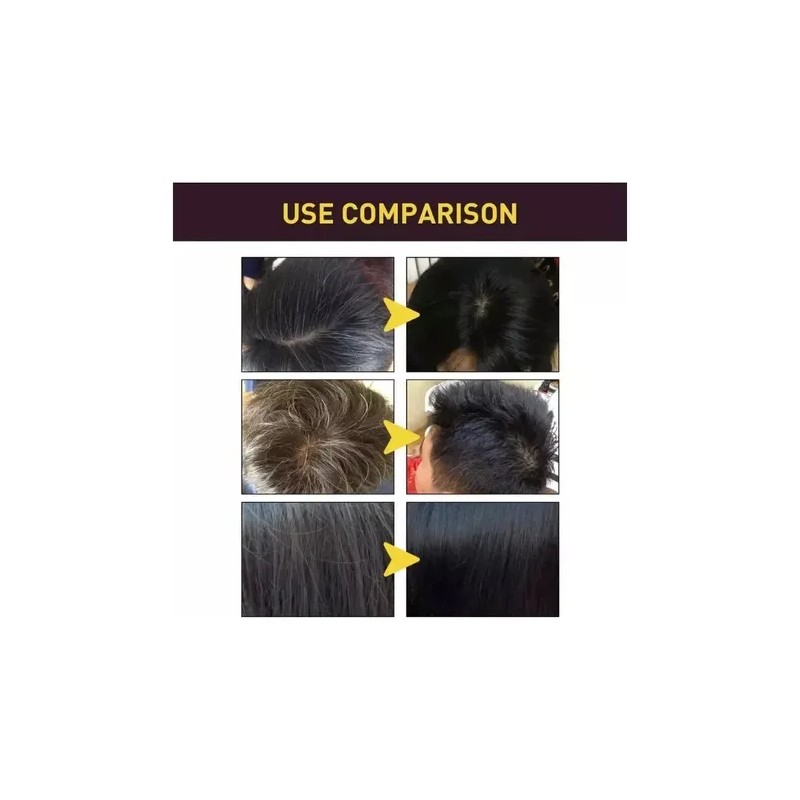 Para 2pc Shampoo Para Cubrir Canas Tinte Negro