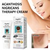 Acanthosis Nigricans Crema, Crema Correctora de Manchas Oscuras,- Axilas, Cuello,