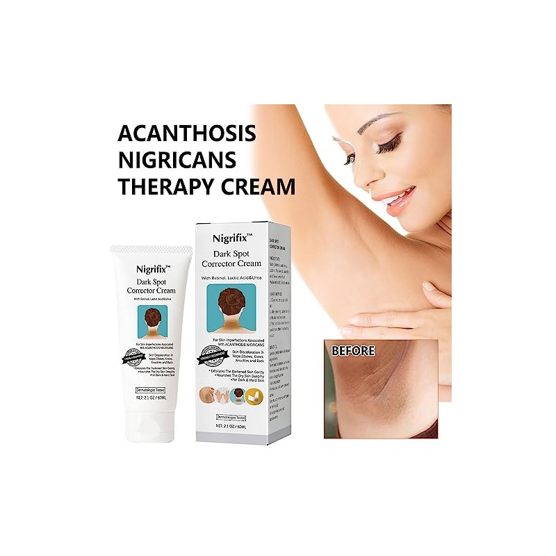 Acanthosis Nigricans Crema, Crema Correctora de Manchas Oscuras,- Axilas, Cuello,