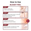 SKIN1004 Zombie Beauty Bloody Peel AHA 17 Peeling Solution 1.01