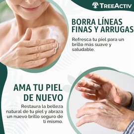 TreeActiv Crepey Skin Repair Treatment | Anti-Aging | Anti-Wrinkle | Organic Ingredients for Face, Neck, Chest, Legs & Arms | Hyaluronic Acid, Alpha H