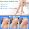 ElevateTech 4Pcs Pumice Stone for Feet, Foot Callus Remover Pedicure