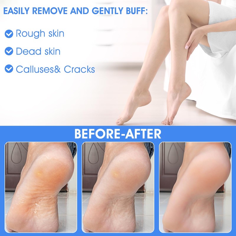 ElevateTech 4Pcs Pumice Stone for Feet, Foot Callus Remover Pedicure