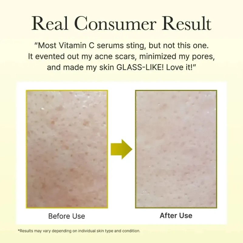 Dd Arencia Vitamina C Booster Shot Serum Con Glutatión Ww