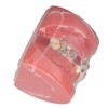 Demonstration Orthodontics Dental Model Disassembled Resin Teeth Model for Teaching
