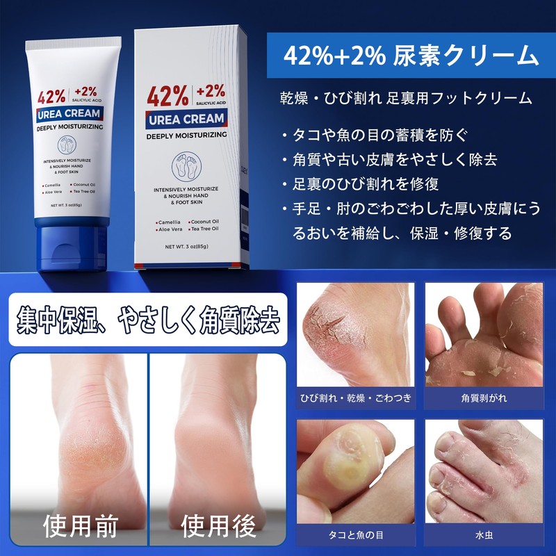 Urea Cream 42%, 3.0 oz (85 g) Urea Moisturizing Moisture