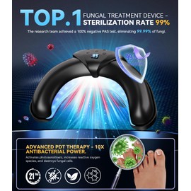 Upgrade Nagelpilz lasergerä für Zuhause【99% Nagelpil in 3 Min. beseitigt】【Intelligenter Timer 99/60/30 Sekunden】Laser Gegen Nagelpil Hohe Qualität,Zuverlässig Universal für Beide Hände/Füße