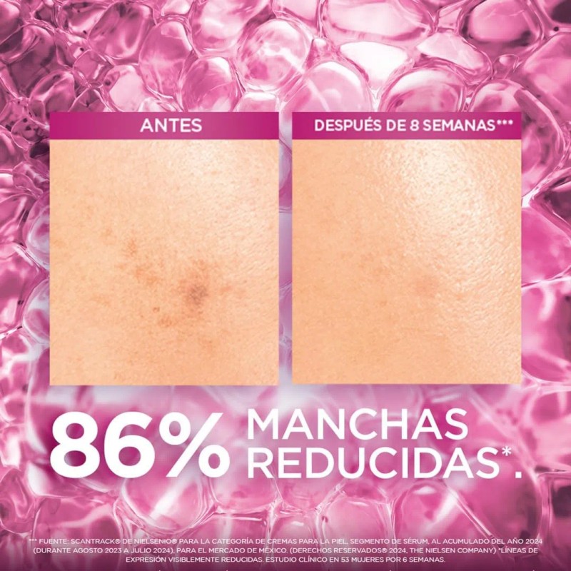 Oréal Paris Kit Anti Manchas Glycolic Bright Rutina Completa Ácido