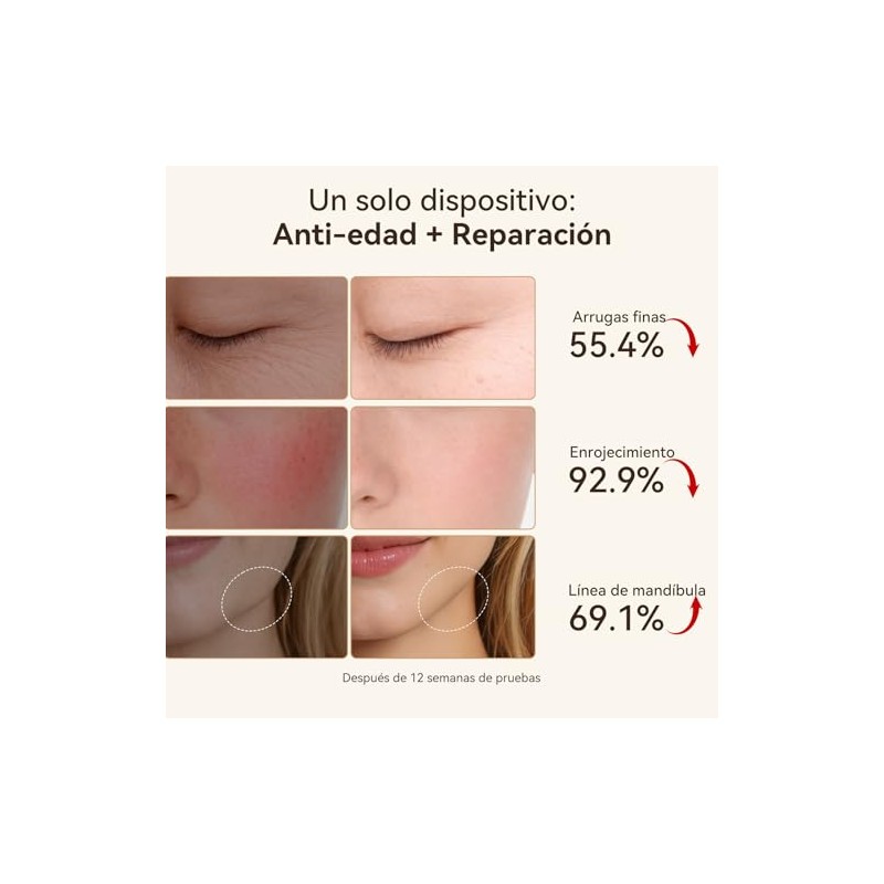 Probióticos para Mujer 120 cápsulas | 60 Billones con Bromelina
