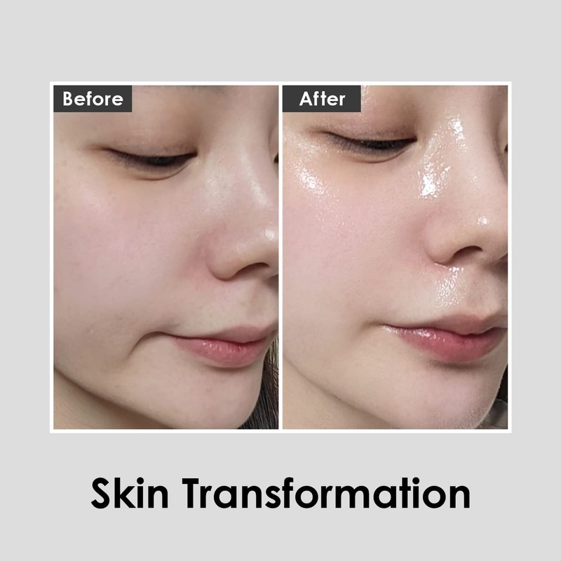 Red Lacto First Collagen Essence