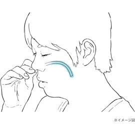いびきを防ぐ一般医療機器：ナステント クラシック (右130mm Soft)