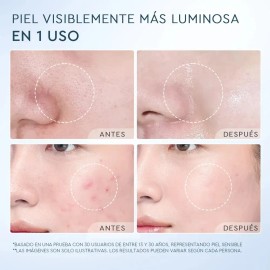 Glad2glow Deep Pore Limpiador Facial Anti Acné Bha Momento De Aplicación Día/noche Tipo De Piel Todo Tipo De Piel