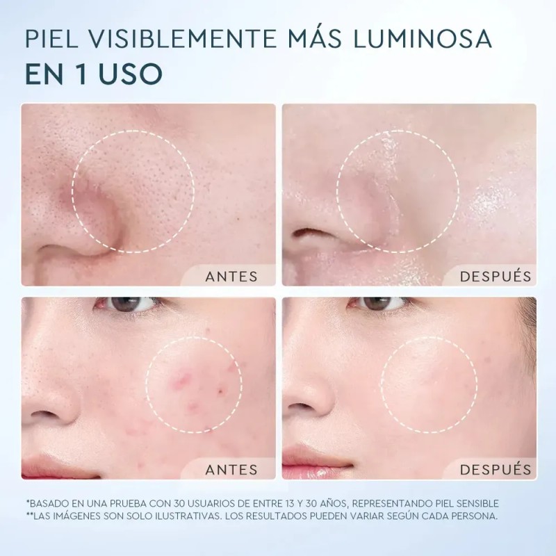 Glad2glow Deep Pore Limpiador Facial Anti Acné Bha Momento De