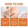 20g Skin Care Cream, Can Relieve Redness, Itching, Relieve and